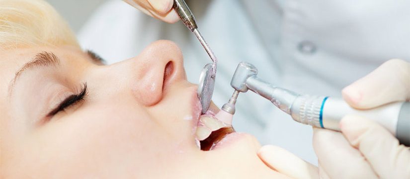 dental cleaning services