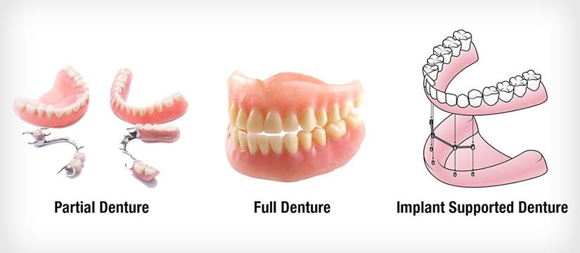 dentures services