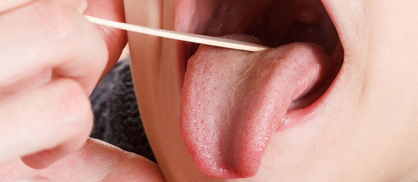 oral cancers by hpv